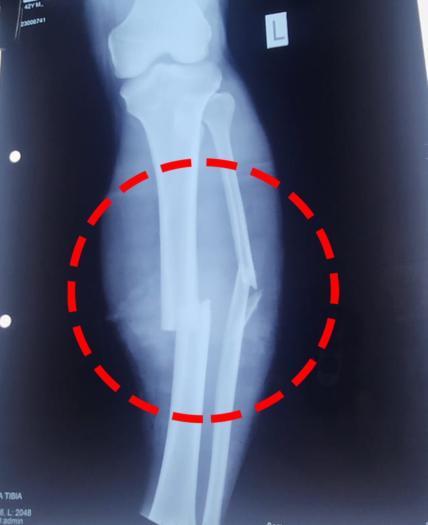 Attack On Toll Plaza 2