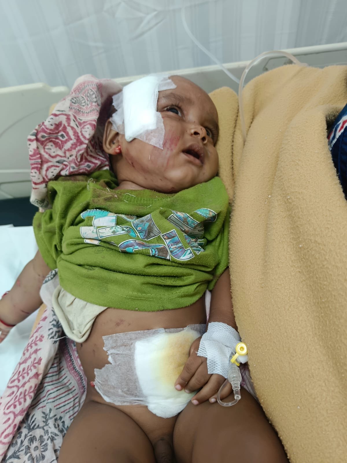 Pitbull Attacks Child